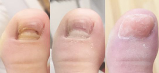 P&eacute;dicurie m&eacute;dicale