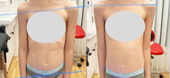 Th&eacute;rapie neurosensorielle